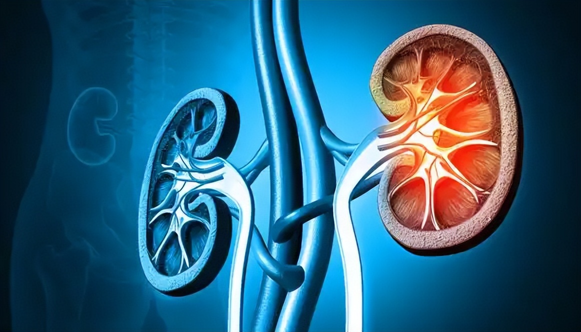 肾衰死亡的人越来越多？医生劝告：天热宁可吃冰棍，也别吃4物