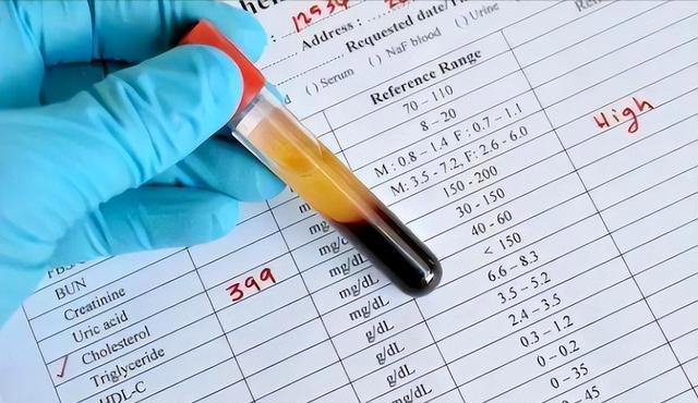 上了年纪的人，要少碰玉米？医生忠告：别等身体出毛病了，才后悔