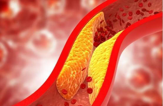 手背血管能看出寿命长短？医生：血管若有这些特征，恭喜你很健康