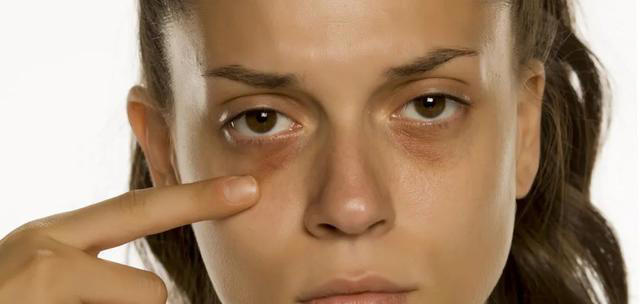 肝变硬，头部会有5个异常，如果你都没有，说明肝脏还很健康