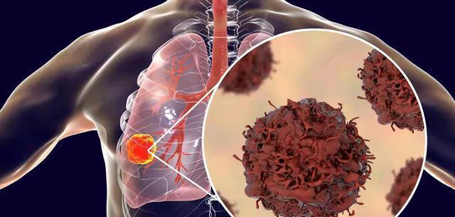 身体一天能承受几根烟？提醒：爱抽烟的人若出现3种迹象，戒了吧