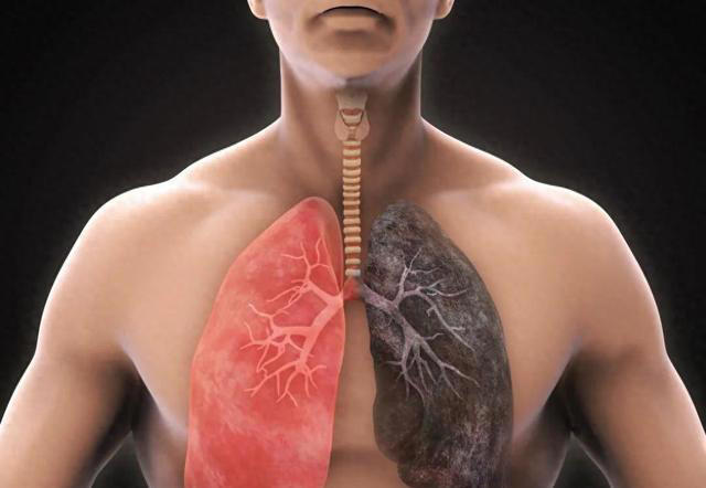 经常抽烟的人，多吃6种食物，肺可能会很“舒服”