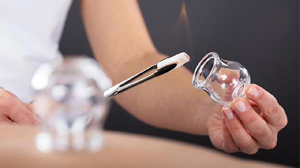 拔火罐吸出来的瘀血，是什么？是身体里的毒素吗？听听医生怎么说