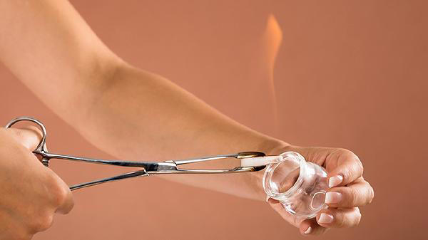 拔火罐吸出来的瘀血，是什么？是身体里的毒素吗？听听医生怎么说