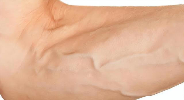 为什么有人手臂青筋凸起，有的人几乎看不到青筋，这是怎一回事？