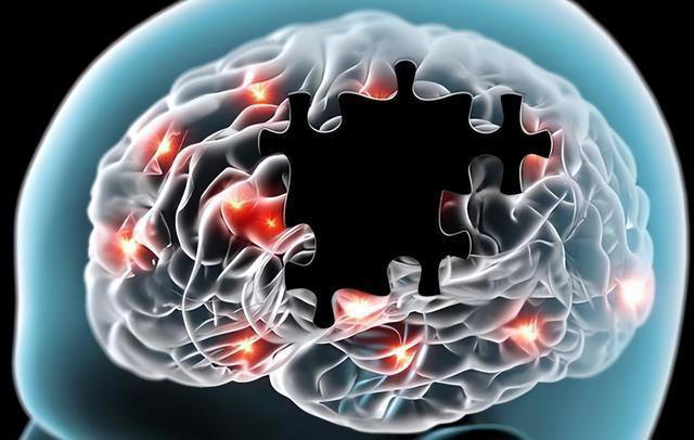 脑供血不足的人，起床时常有4种表现，若你没有，说明大脑很健康