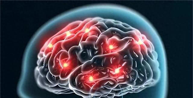 脑供血不足的人，起床时常有4种表现，若你没有，说明大脑很健康