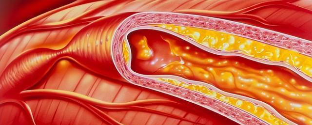 脑供血不足的人，起床时常有4种表现，若你没有，说明大脑很健康