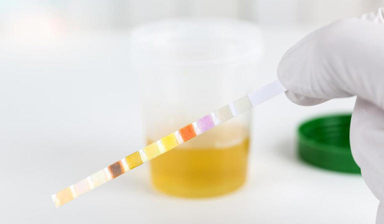 高血压会出现5个严重并发症，注意预警信号，做好3点预防