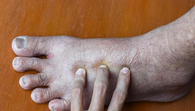 心肺功能开始“衰竭”时，身体会发这6个警告，别不当回事忽视了