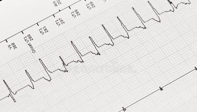 心肺功能开始“衰竭”时，身体会发这6个警告，别不当回事忽视了