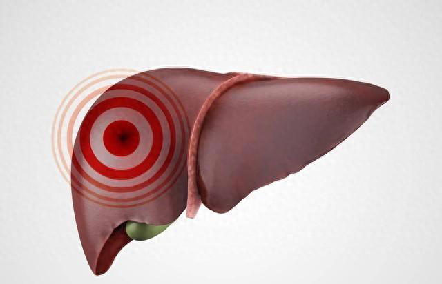 肝受损的人，不管男女，平常多食用这3种食物，或有助于肝脏健康