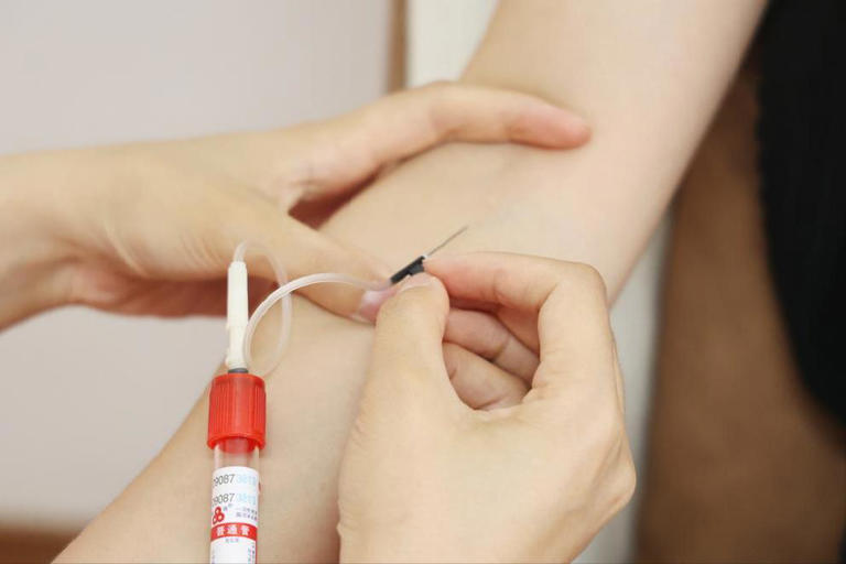 医生强调：患上脂肪肝的人，务必少吃这几种食物，或能预防并发症