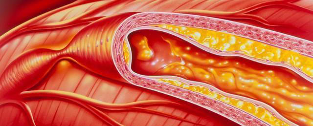 人老了要注意！红薯南瓜尽量少吃，否则适得其反！