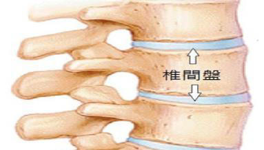 腰椎间盘突出，日常如何保养腰椎？