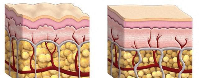 关于减肥的 9 个真相，看完少走很多弯路