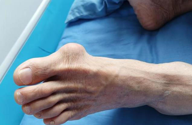 牛肉虽好吃，这4类人得悠着点，乱吃小心身体吃不消