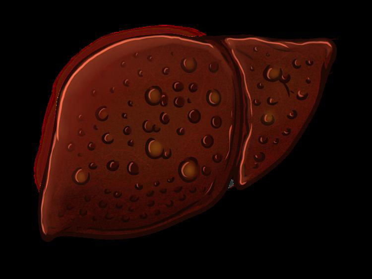 肝脏悄悄受伤的六大信号！早识别早防肝硬化(本图只做示意,与正文内容无关)