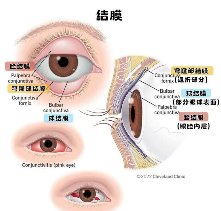 眼白有个小黑点，正常吗？有这些特点要当心