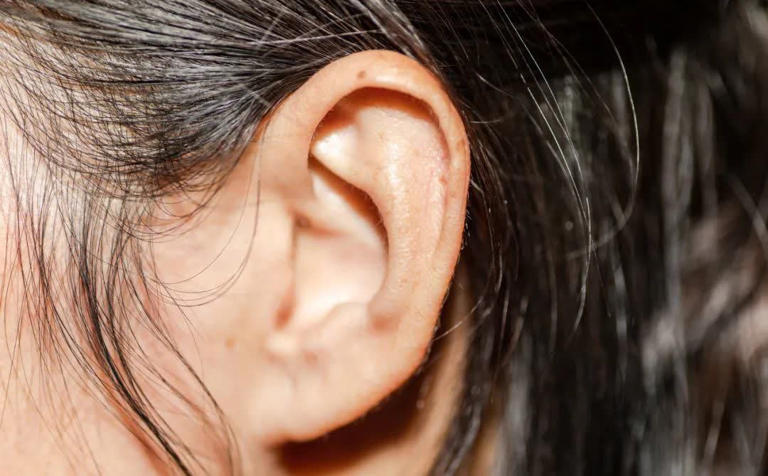 真的想问：耳朵周围黄黄的分泌物，到底是什么？