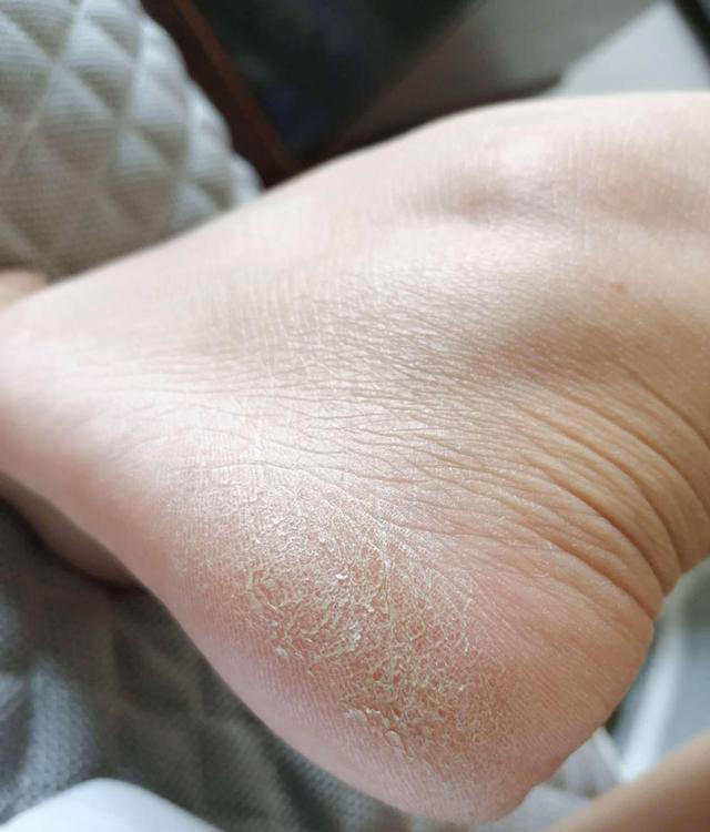 穿袜子睡觉和不穿袜子睡觉，哪个睡得更香？医生给出研究分析