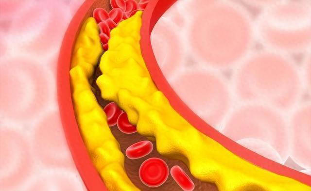 “高胆固醇”食物榜单公布：鸡蛋排最后，第1名有些人还当成补品