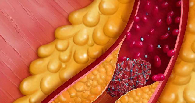 “高胆固醇”食物榜单公布：鸡蛋排最后，第1名有些人还当成补品