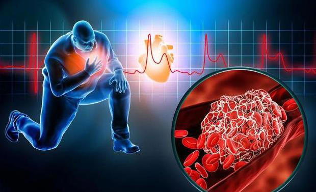 心梗来临前的 6 个预警信号！记住这些，关键时刻能救命！