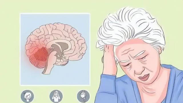 大脑开始萎缩，一般出现4个反应，多吃5种健脑食物，辅助降低风险