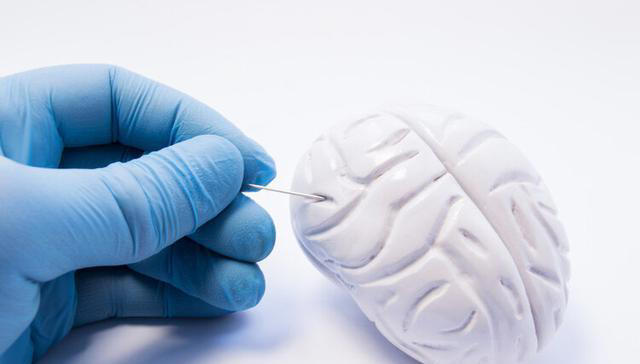 大脑开始萎缩，一般出现4个反应，多吃5种健脑食物，辅助降低风险