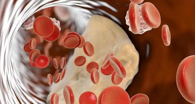 心脏与花生的关系，医生：若想保护心脏健康，尽量少吃这4种坚果