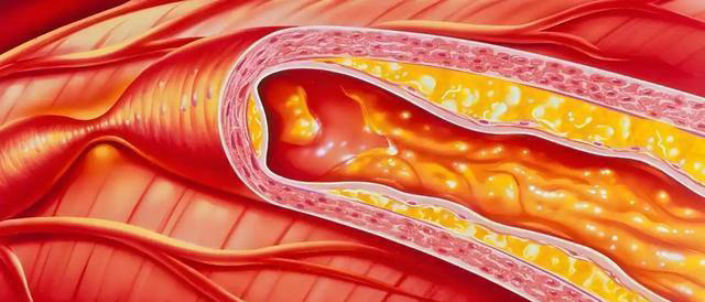 心脏与花生的关系，医生：若想保护心脏健康，尽量少吃这4种坚果