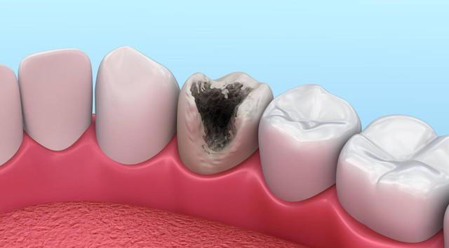 别再误解！红枣并非只为补血。长期吃红枣，好处坏处全解析