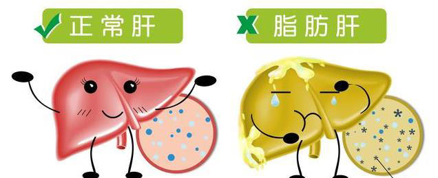 每天慢跑40分钟却查出肝癌，6个坏习惯害人，医生说白跑了