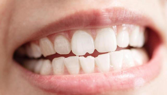 医生提醒：最伤牙齿的行为，不是不刷牙！而是频繁的去做这5件事