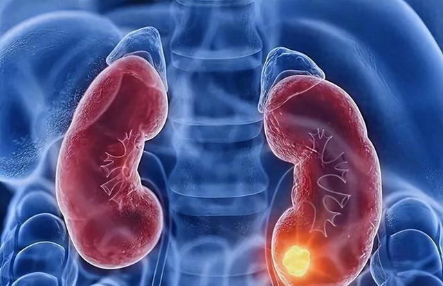 出现这4种症状，可能肾脏出问题了！做好预防，远离4个发病因素