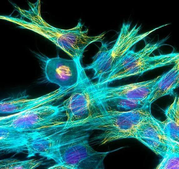 大脑亿万粒子忙碌，物理规律管得严，意识还能自由吗？