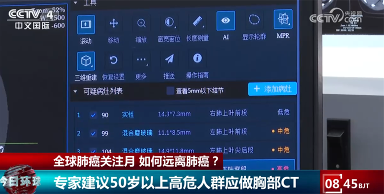 肺结节是否需要立刻手术？如何远离肺癌？这篇关于健康的提示请收藏↓
