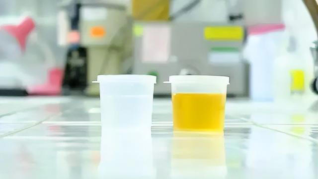 “百病从肝起”，肝病早期都有五个信号，一旦出现，千万要注意了