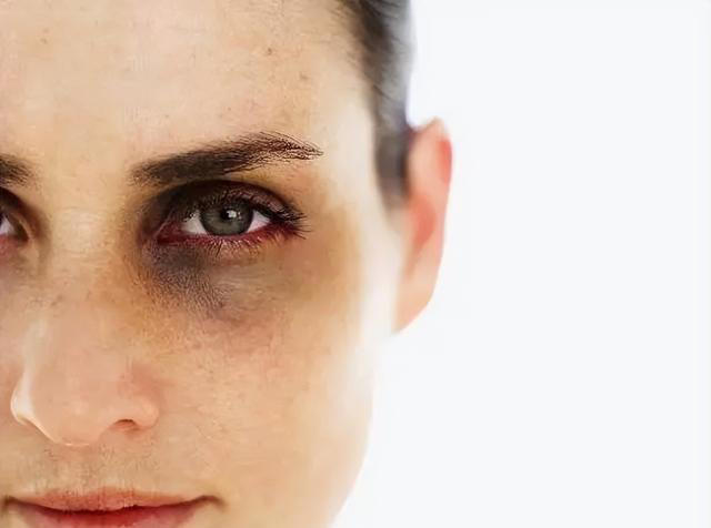 “百病从肝起”，肝病早期都有五个信号，一旦出现，千万要注意了