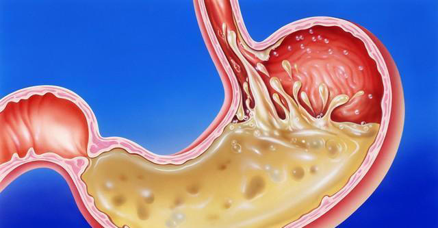 高血压谨记：早晨忌一件事，中午避两件事，晚上弃三件事