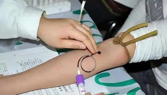 听一句劝：查出高血脂，就不要再吃这几种豆制品了，血脂或会飙升