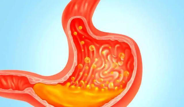 医生直言：经常不吃晚餐，除了可以变瘦，或还可以缓解这5个问题