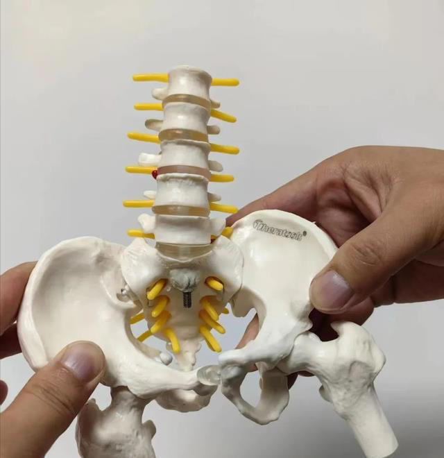 久坐就会腰疼或屁股疼痛，是不是腰椎间盘突出引发？该怎么办？