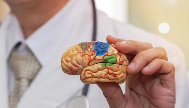 冬季容易诱发脑梗？医生提醒：不想突发脑梗，冬天要注意这5件事