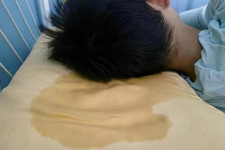 汗液是心脏最好的反馈！医生发现：汗液出现5症状，多是心梗前兆