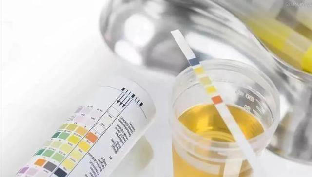 医生：肾脏不好的人，不管有没有吃药，3种习惯要改掉，稳定病情