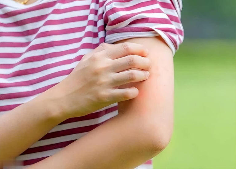 提醒：肾衰竭早期不是腰疼，而是身上4大异常要注意