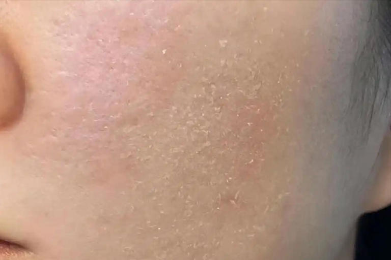 研究显示立冬后常吃蒸红薯，不久身体或有6个改善