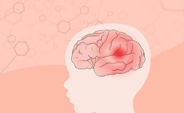 中国脑梗越来越多，美国却在减少? 除了补充叶酸，这3件事也要做